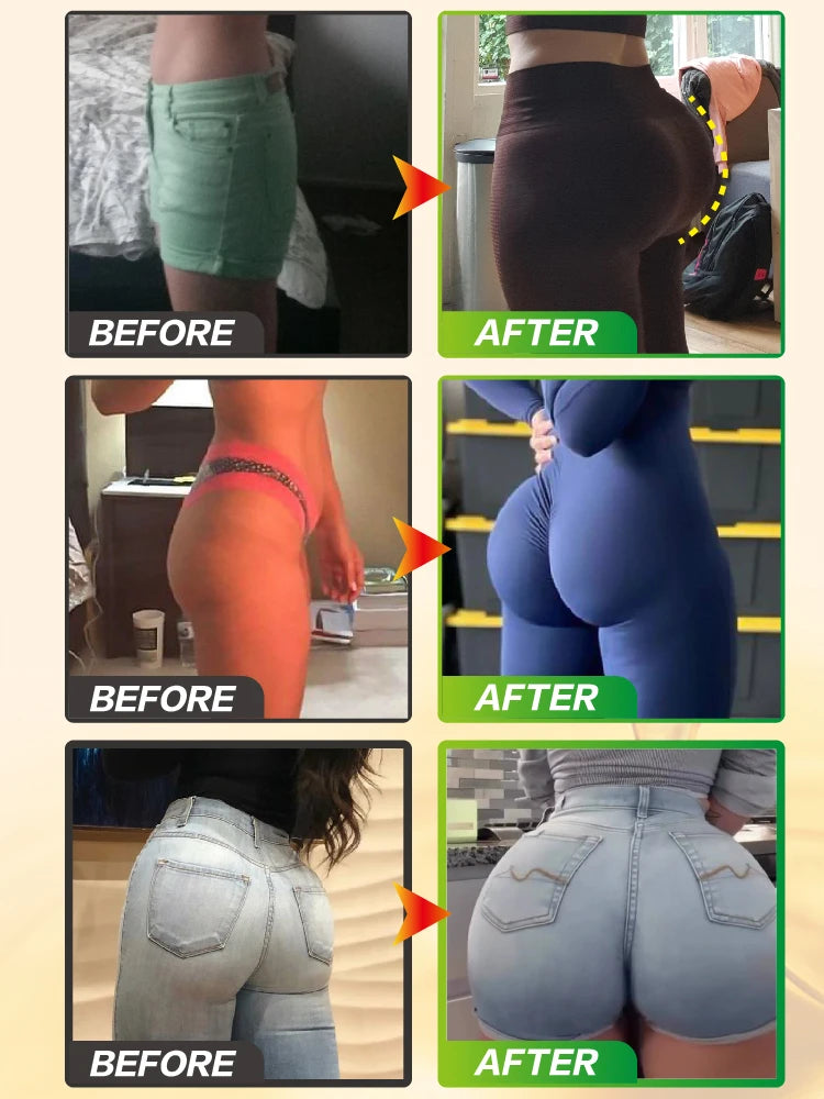 huiles essentielles pour grosses fesses