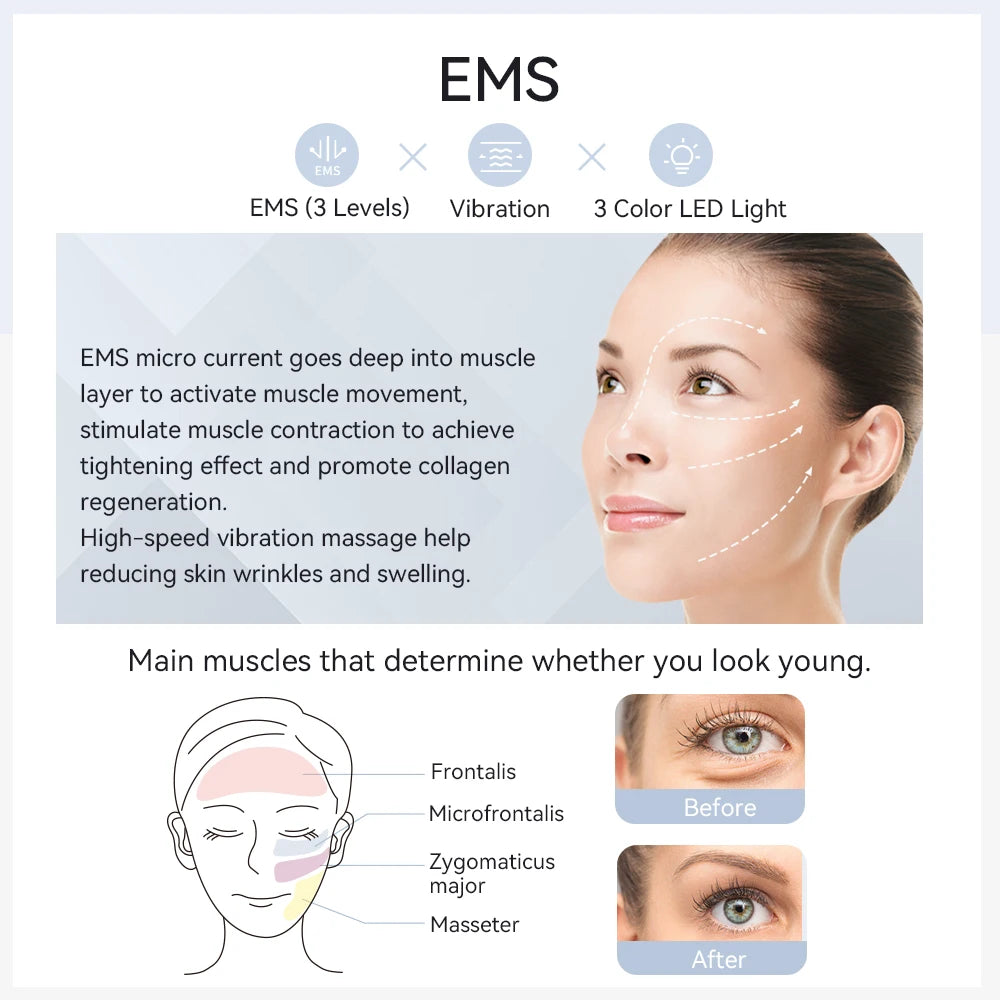 ANLAN Masseur facial EMS Pro Lifting du visage Rajeunissement de la peau Compression chaude et froide Nettoyage en profondeur Appareil de beauté anti-âge