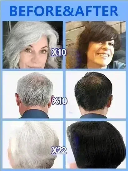 Nouveau tueur de cheveux blancs, liquide d'essence Polygonum Multiflorum élimine les cheveux gris et restaure la couleur naturelle des cheveux en 7 jours 2025