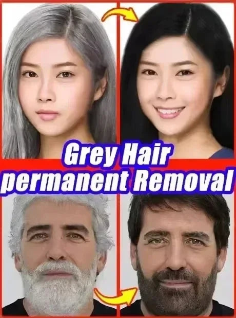 Nouveau tueur de cheveux blancs, liquide d'essence Polygonum Multiflorum élimine les cheveux gris et restaure la couleur naturelle des cheveux en 7 jours 2025