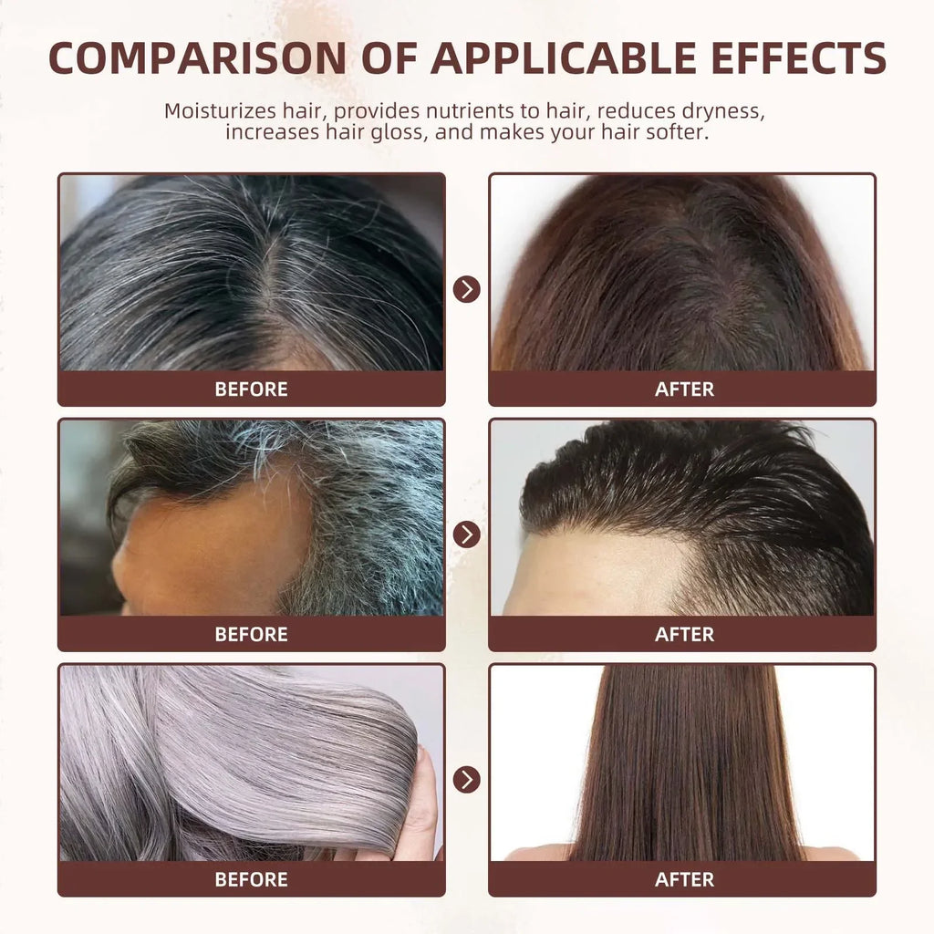 Nouveau tueur de cheveux blancs, liquide d'essence Polygonum Multiflorum élimine les cheveux gris et restaure la couleur naturelle des cheveux en 7 jours 2025
