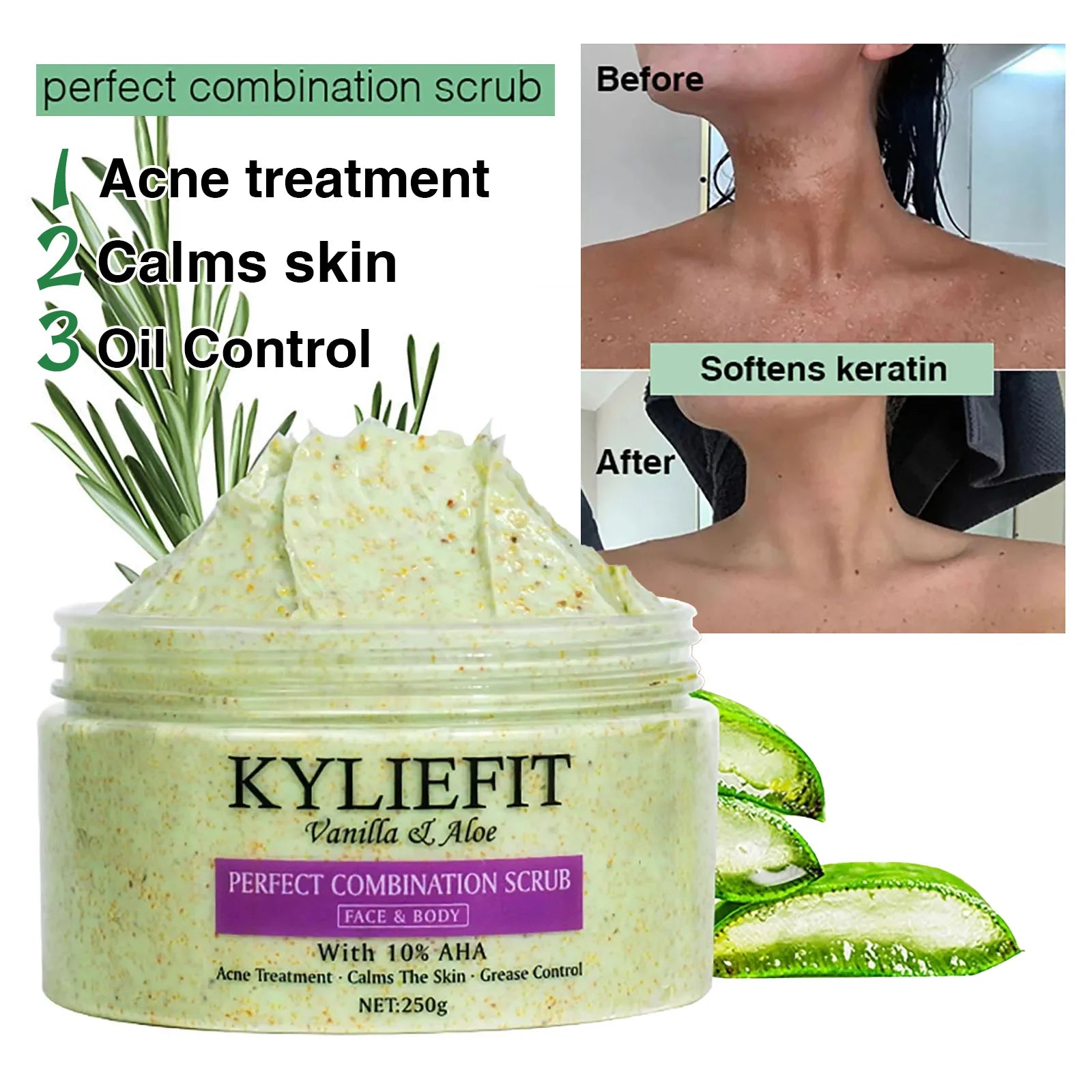 AILKE Savon blanchissant à l'aloe vera, élimine l'acné, les boutons, la peau rayonnante, améliore le lustre cutané, le bain végétalien pour tous les types de peau