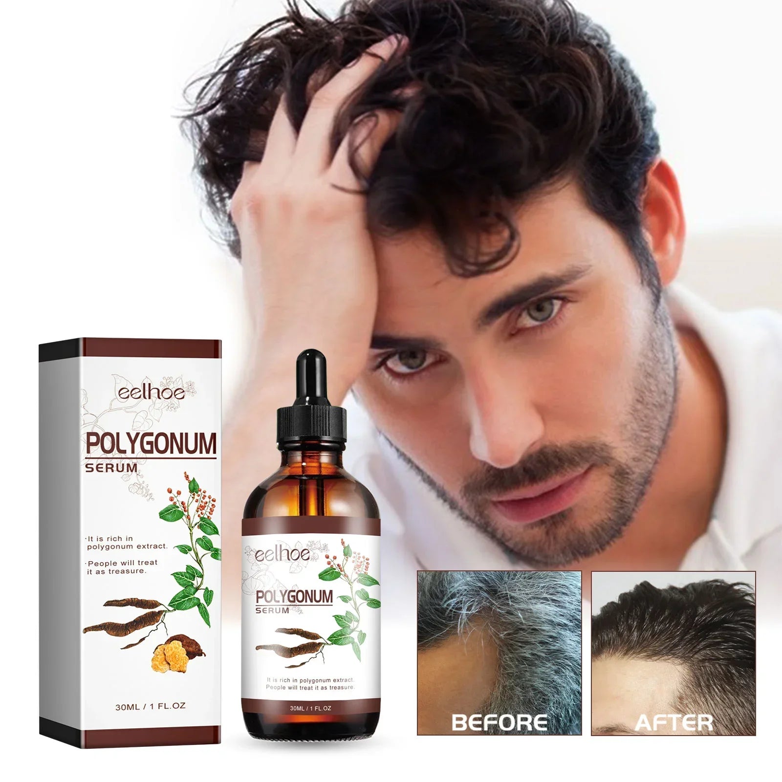 Nouveau tueur de cheveux blancs, liquide d'essence Polygonum Multiflorum élimine les cheveux gris et restaure la couleur naturelle des cheveux en 7 jours 2025