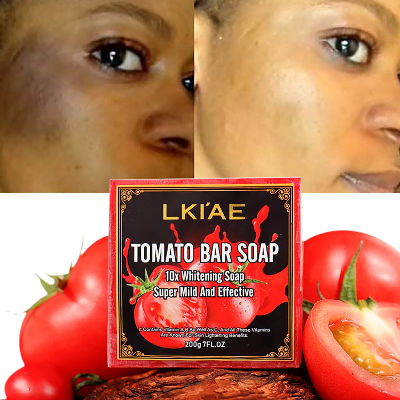 AILKE Savon blanchissant à l'aloe vera, élimine l'acné, les boutons, la peau rayonnante, améliore le lustre cutané, le bain végétalien pour tous les types de peau