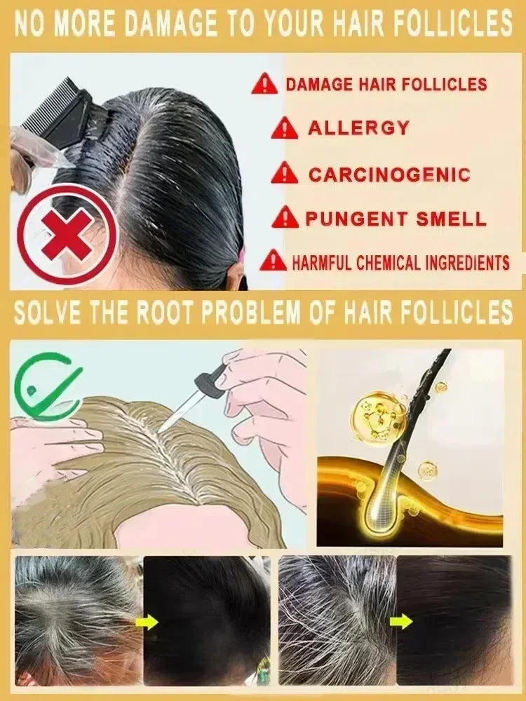 Nouveau tueur de cheveux blancs, liquide d'essence Polygonum Multiflorum élimine les cheveux gris et restaure la couleur naturelle des cheveux en 7 jours 2025