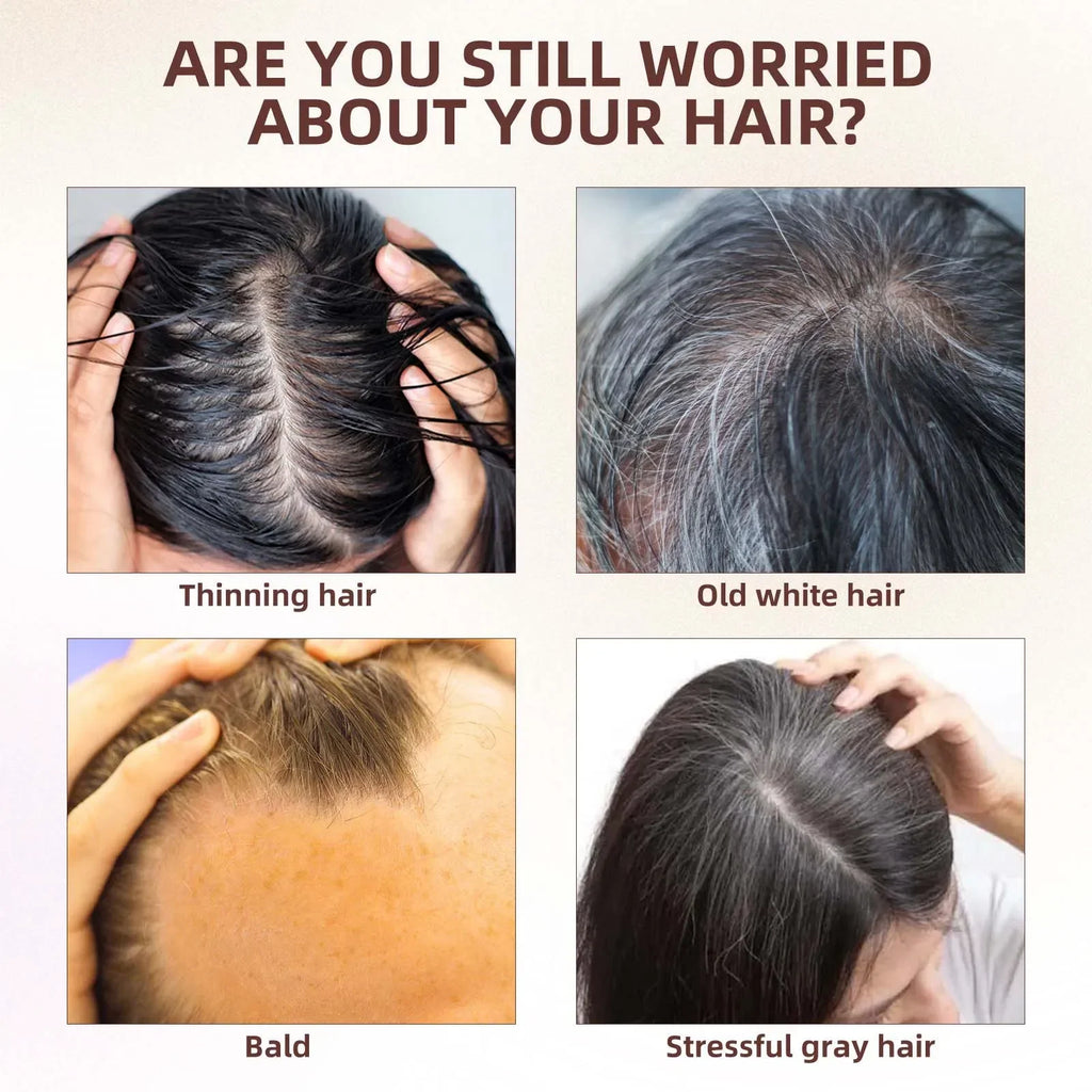 Nouveau tueur de cheveux blancs, liquide d'essence Polygonum Multiflorum élimine les cheveux gris et restaure la couleur naturelle des cheveux en 7 jours 2025