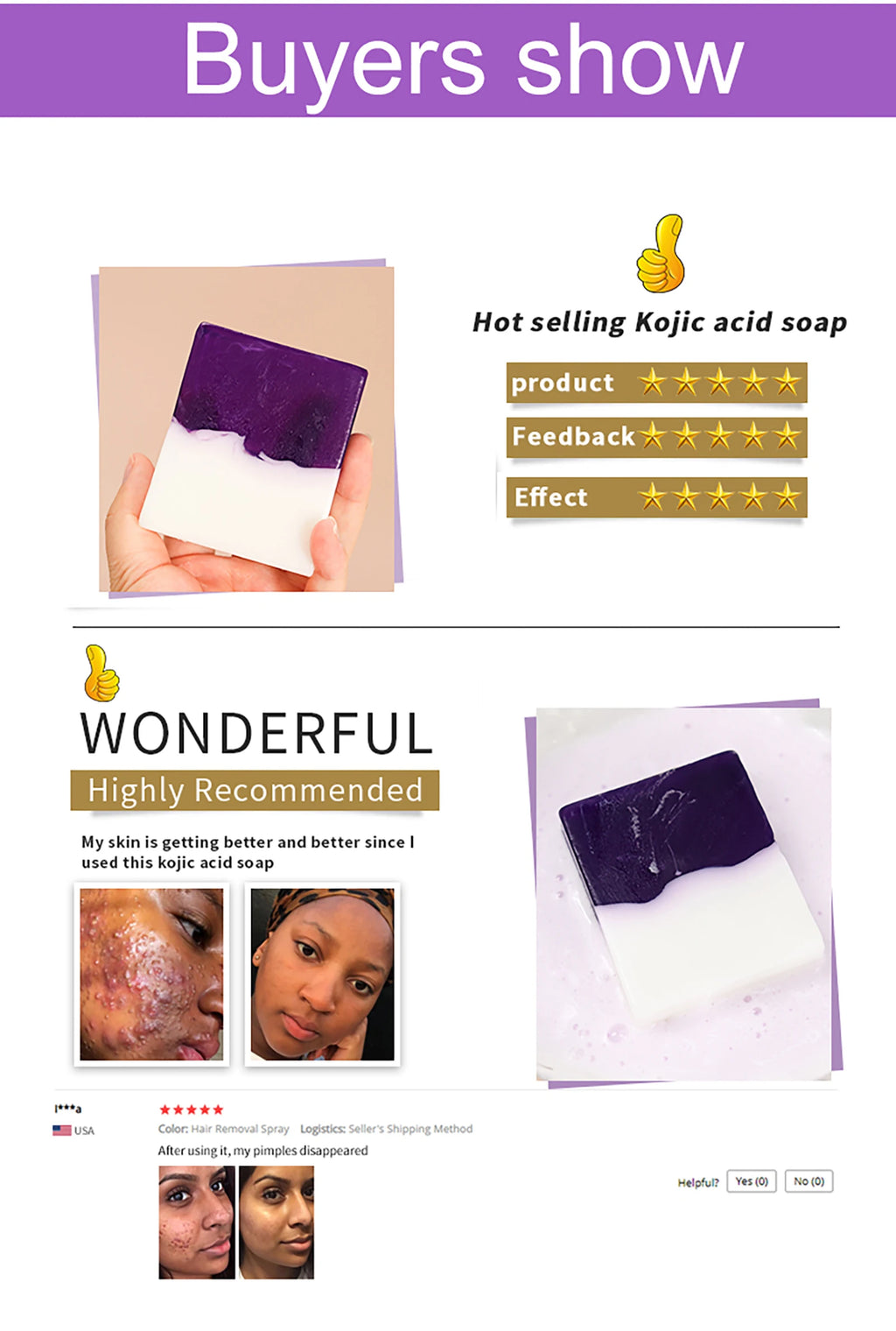 AILKE Anti taches, savon pour peau lisse, barre parfumée, pour peau noire, peau foncée, peau caramel, éclaircissant, blanchissant, pour le visage et le corps