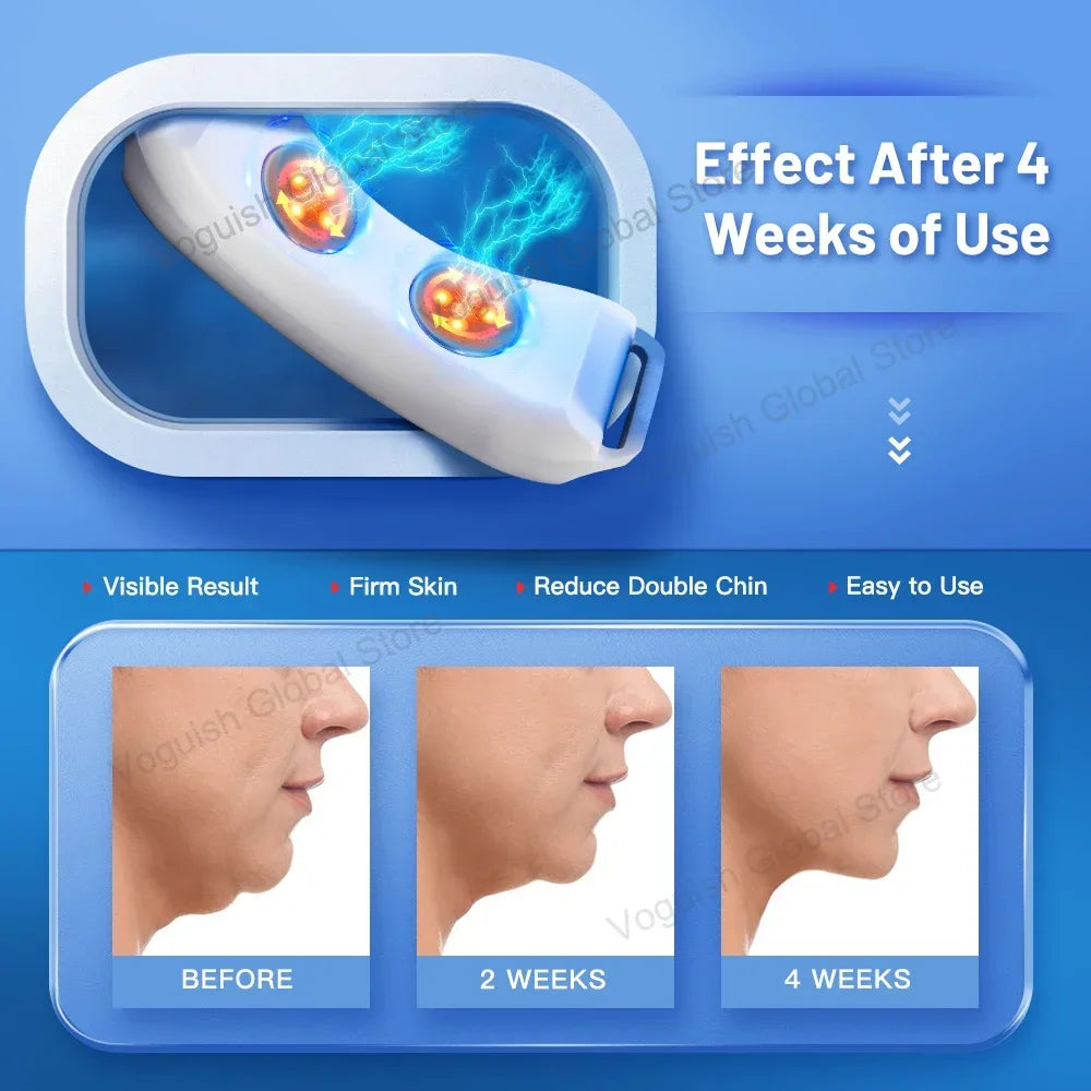 Ohio eur facial à double vibration pour le ruisseau, appareil de beauté, lifting du visage, ceinture de mise en forme, V-Line Up, Ems Facial Lifter