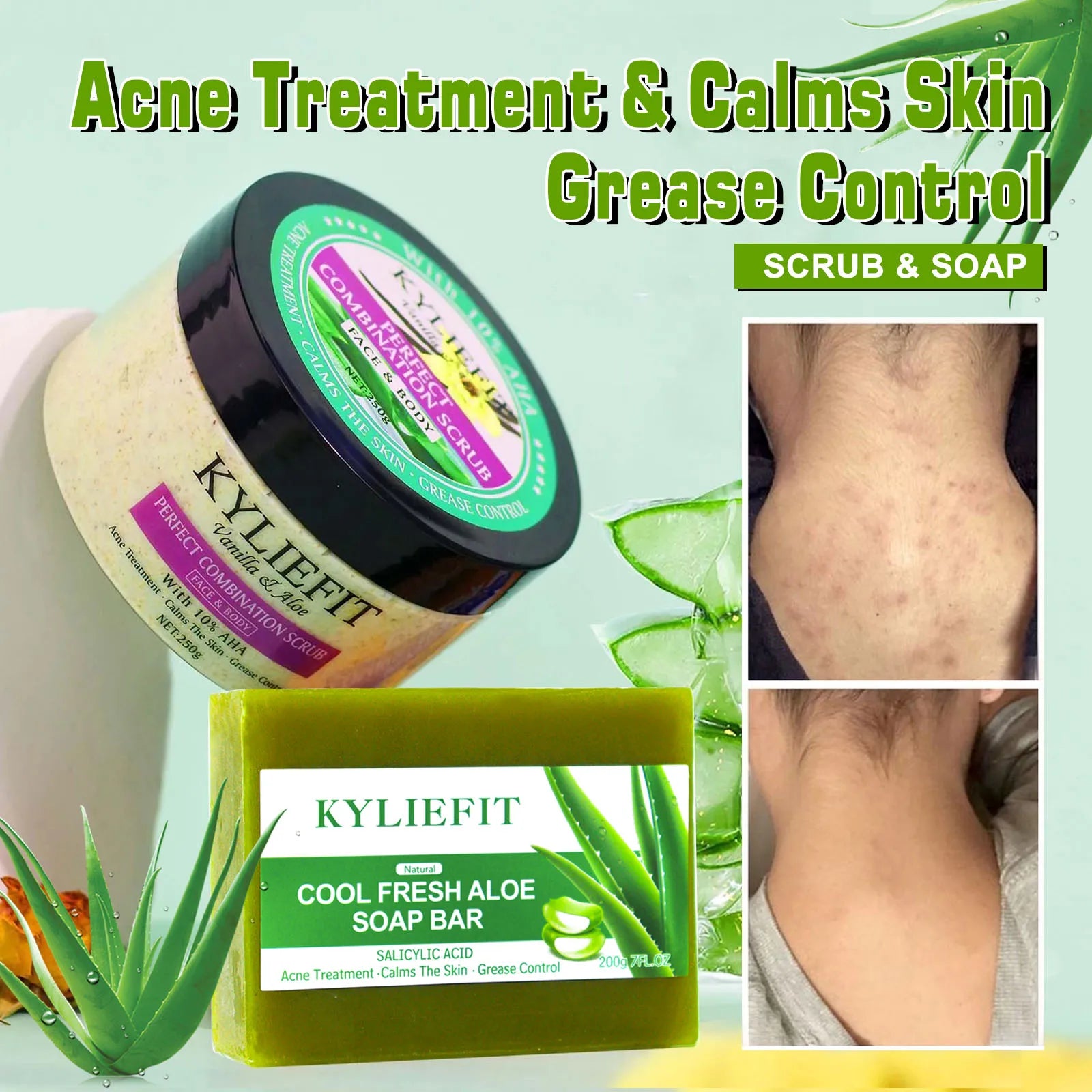 AILKE Savon blanchissant à l'aloe vera, élimine l'acné, les boutons, la peau rayonnante, améliore le lustre cutané, le bain végétalien pour tous les types de peau
